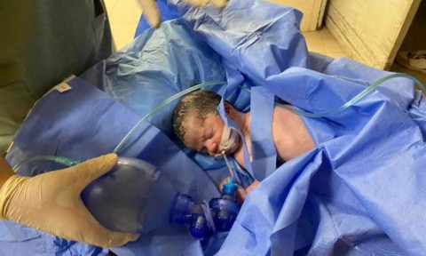 غزة تُقتل جوعا.. 40 ألف رضيع مهددون بالموت خلال ساعات