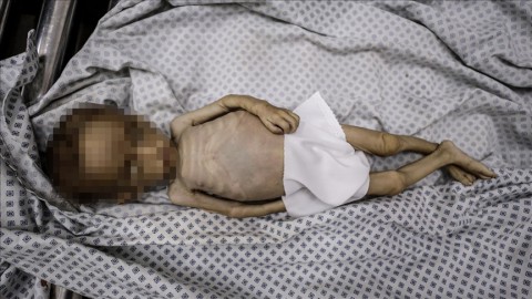 آلة القتل الصهيونية تواصل اجرامها بغزة: 197 شهيدًا بينهم 96 طفلا.. 4 حالات وفاة جديدة نتيجة تفشي المجاعة وسوء التغذية
