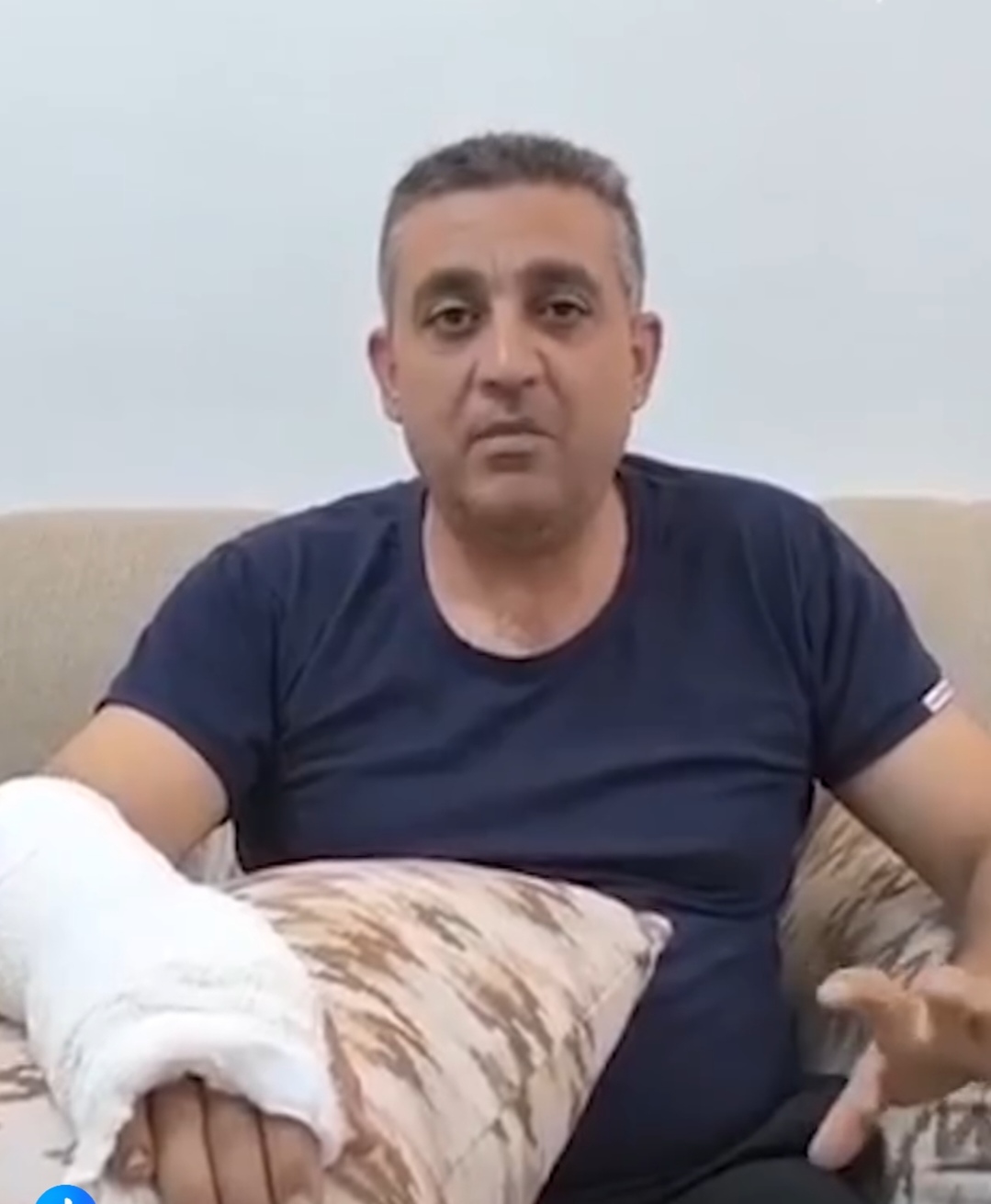 كلب ضال يعقر أبا دافع عن طفله في الزرقاء