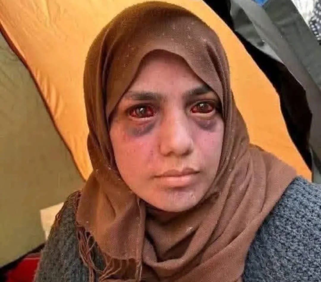 احترقت عيناي بالدموع... بقلم: سوسن الحلبي