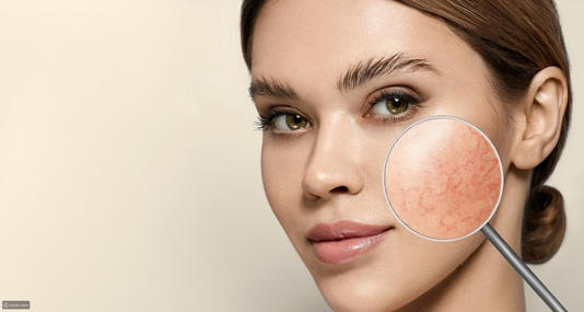 كيفية تجنب حساسية مستحضرات التجميل وحماية بشرتك