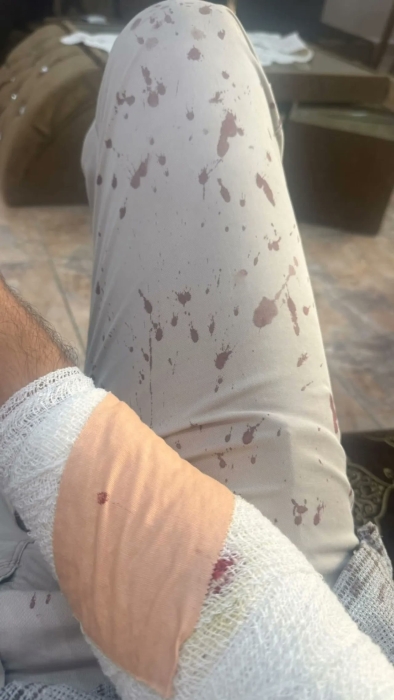 بمنشار.. طالب يعتدي على معلم في الزرقاء